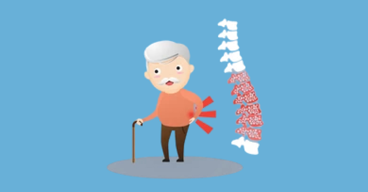 Osteoporosis Symptoms