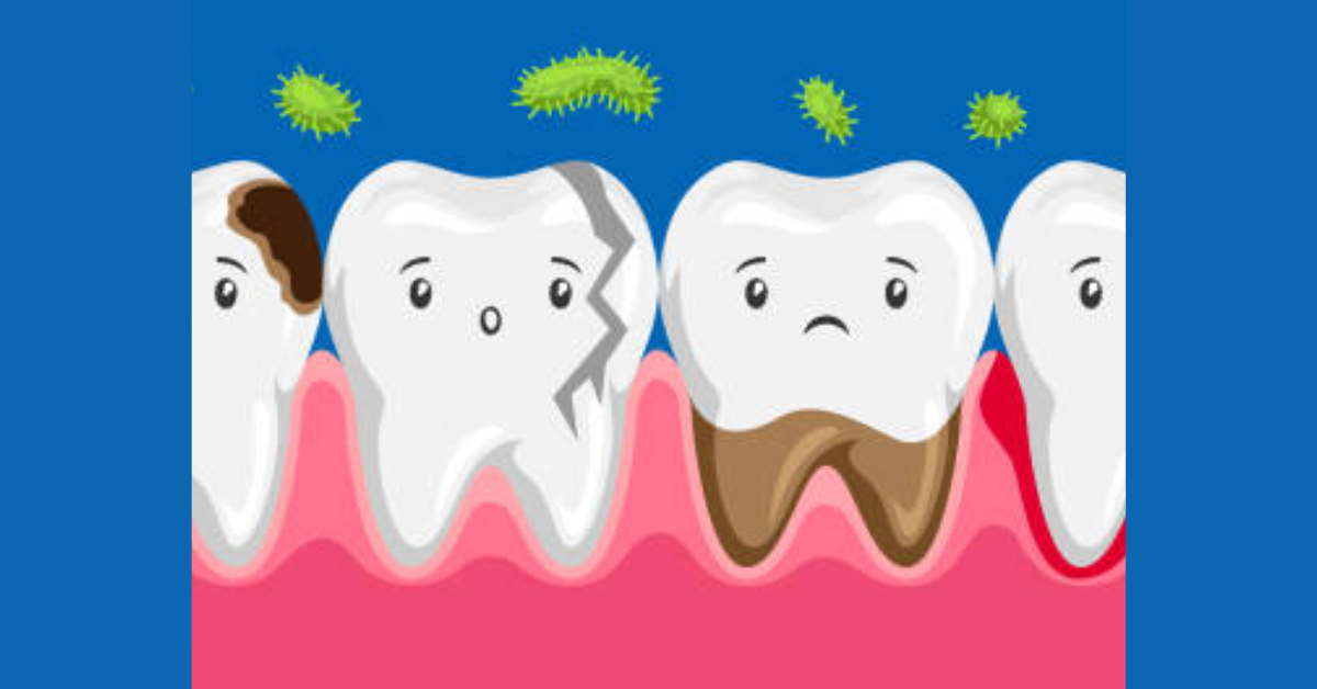 Rotten tooth in Children