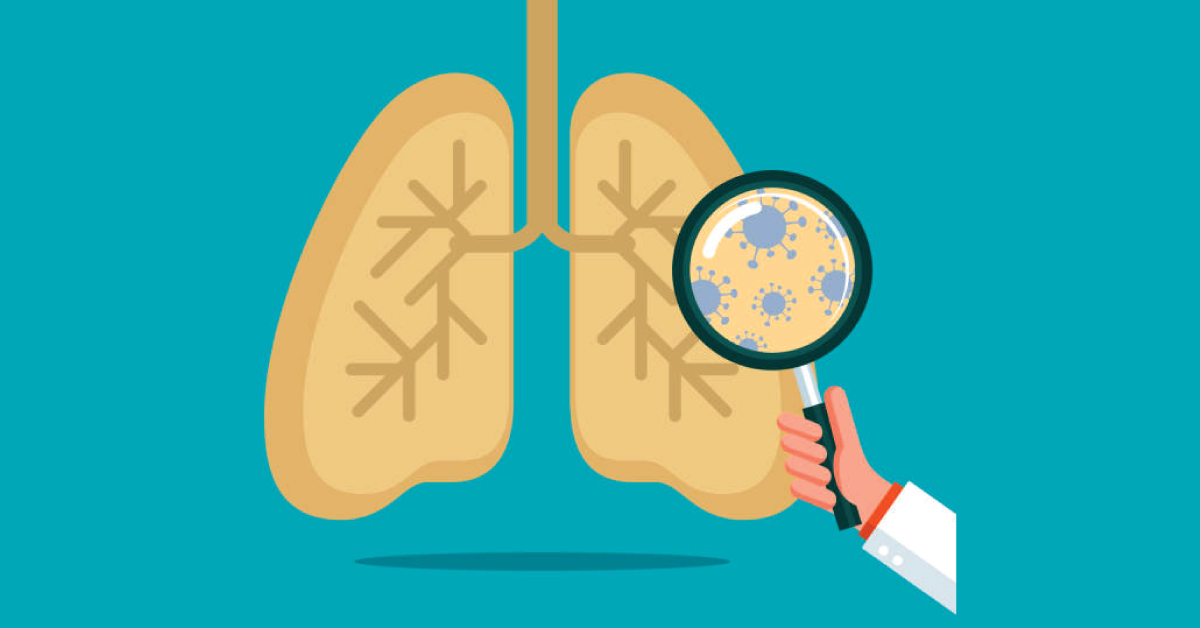 Tuberculosis